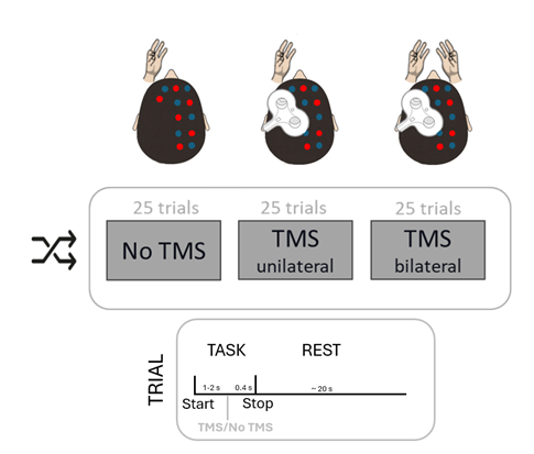 TMS