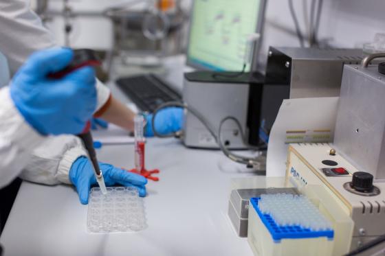 alterazioni neuronali